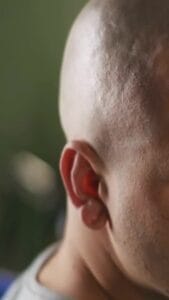 ⚖️Статья 10 расписания болезней ВЛК