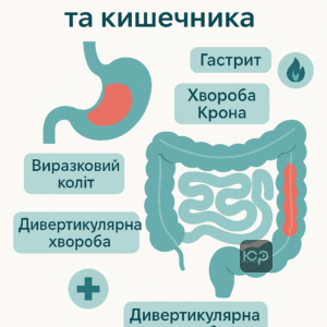 Перелік хвороб шлунка та кишечника за статтею 52 з описом основних захворювань шлунково-кишкового тракту та їх класифікацією за кодами МКХ-10. Інформація стосується гастриту, хвороби Крона, виразкового коліту та інших функціональних розладів травлення.