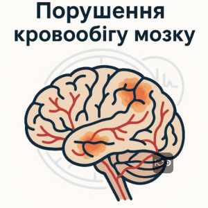 Ілюстрація, що показує порушення кровообігу у мозку при дисциркуляторній енцефалопатії, з акцентом на медичні симптоми та ступінь захворювання для ВЛК.