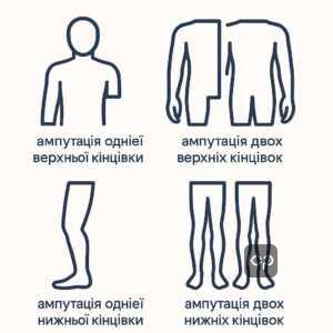 Класифікація ампутацій за статтею 63 Розкладу хвороб: підвищення розуміння ступеня придатності військовозобов'язаних залежно від рівня ампутації кінцівок для військово-лікарської комісії.