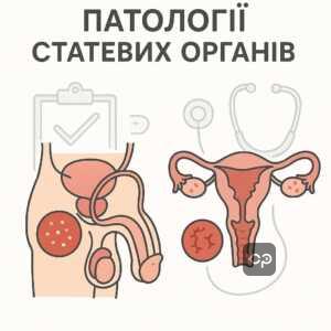 Класифікація патологій статевих органів як підстави для медичної непридатності за ВЛК. Інформація про вплив захворювань репродуктивної системи на стан здоров'я та необхідність лікування в контексті оцінки придатності.