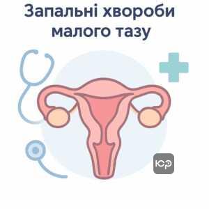 Інформативне зображення про запальні хвороби жіночих статевих органів за міжнародною класифікацією для медичного блогу.